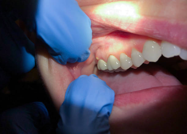 Best Emergency Treatment for Toothache in Judsonia, AR